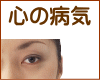 心の病気